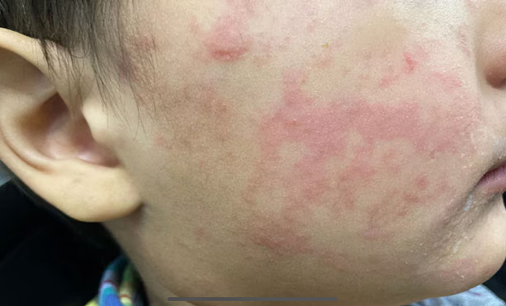 <a href="https://www.epnewsleader.com/post/measles-outbreak-in-texas-reaches-124-cases-one-death-reported" target="_blank">Measles Outbreak in Texas Reaches 124 Cases, One Death Reported</a>