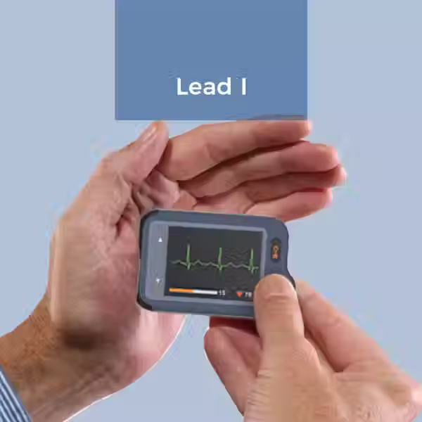 Thumbnail: Wellue Pulsebit™ EX Personal EKG Monitor