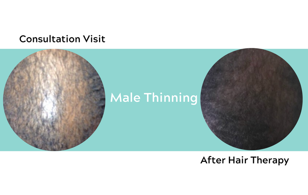 Make It Happen Hair Loss Clinic and Salon