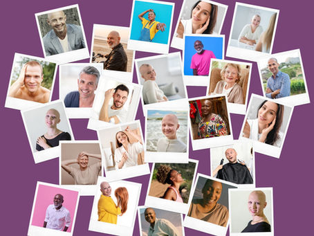 Augustus: Hair Loss Awareness Month - Mythes over Haaruitval
