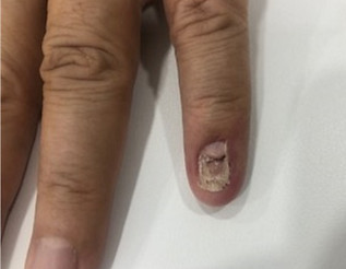 nail after.jfif