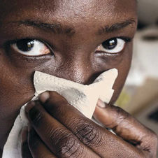 Tuberkulose: Das «Wiedererwachen» einer tödlichen Infektion