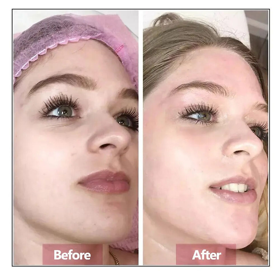 Thumbnail: Hyaluronic Acid Face Serum