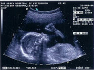 Breastfeeding is Hard!