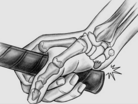 Wrist Pain in Golf: It’s Usually Not From Where You Think