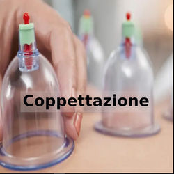 Coppettazione