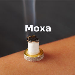 Moxa