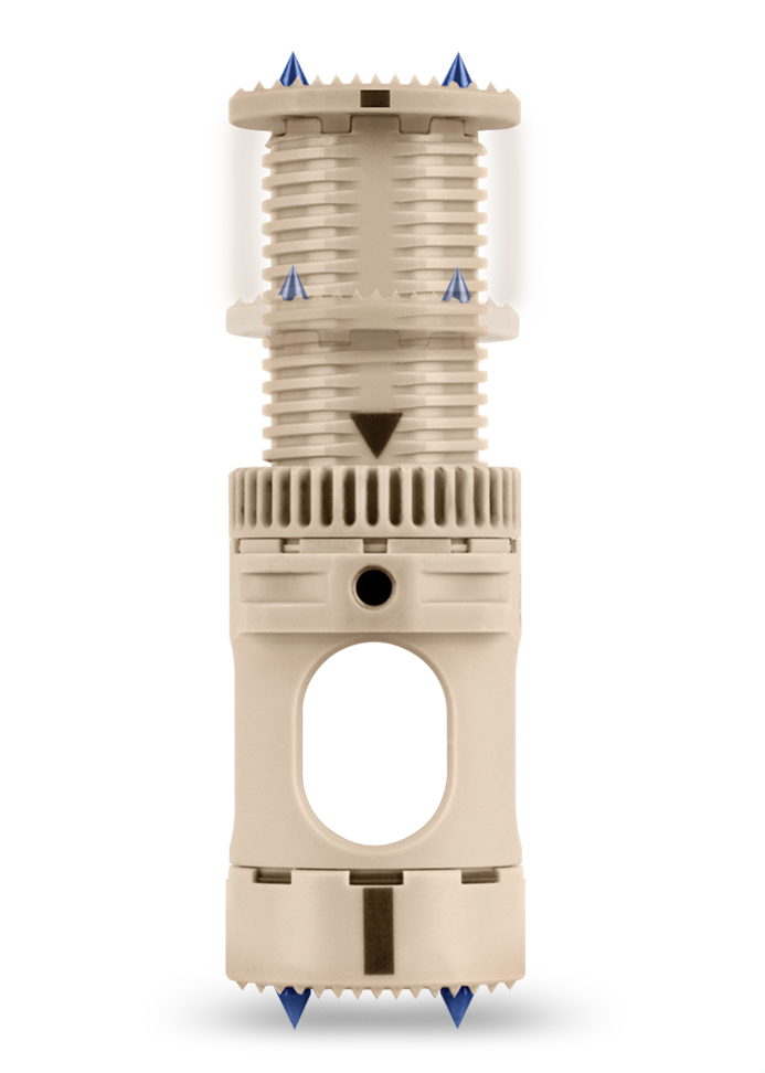 Globus Medical FORTIFY® Expandable Corpectomy Device. Catalog 151.321