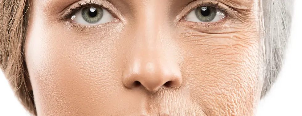 fine-lines-and-wrinkles.webp