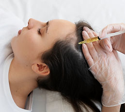 woman-getting-scalp-prp-treatment-high-angle.jpg