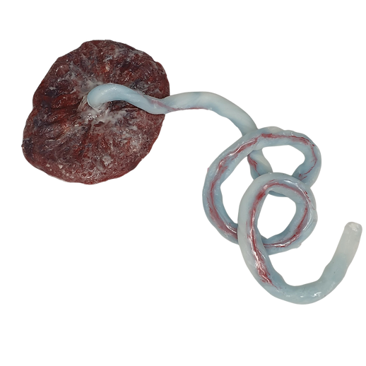UMBILICAL CORD.png