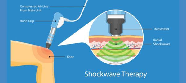 Shockwave graphic explaining how it works for knee pain
