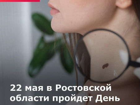 22 мая в России пройдет День диагностики меланомы.