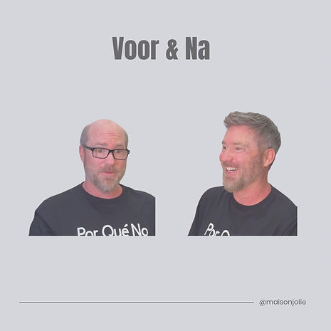 Haarwerken voor mannen - voor & na