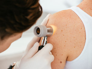 Dermatoscopia