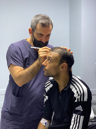 Implant capillaire Turquie