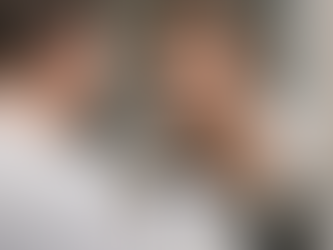 Traçage de la ligne de barbe à Paris, dessin des contours avant greffe de barbe