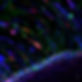 Victor Dieriks Stem cells migrating out of tumorspheres_edited.jpg