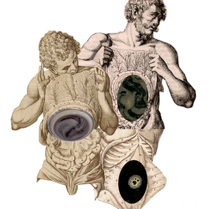 Colon irritable