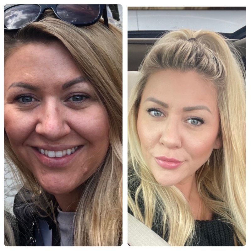 Marissa before and after: skin