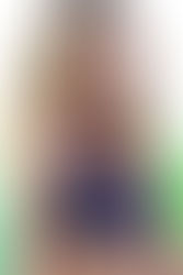 Bra Fitting and Breast Cancer