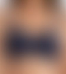 Fit Tips for Wire-Free Bras