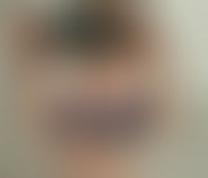 How to Wear Bra Inserts