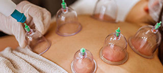 Body Cupping Massage_.jpg