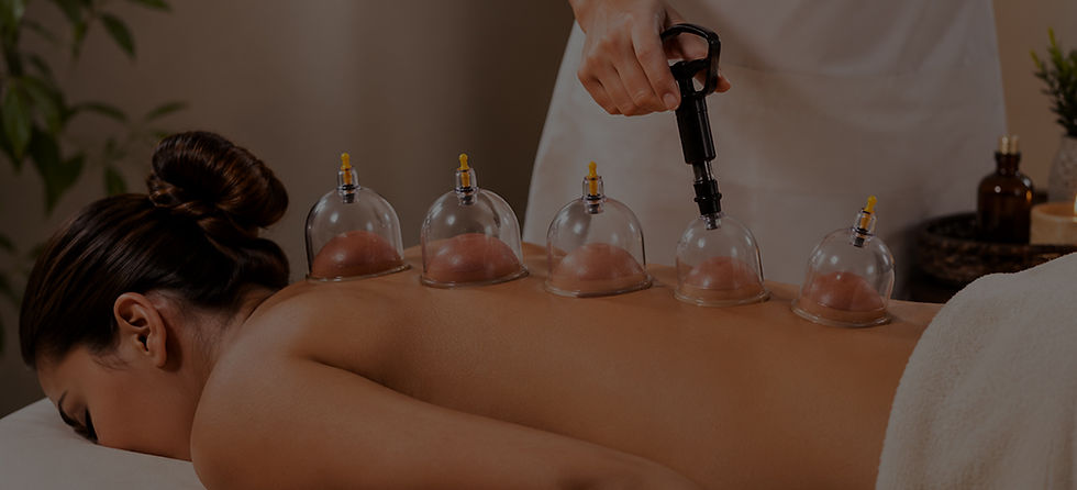 Premium-Cupping-Therapy-in-Dearborn,-MI.jpg