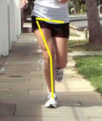 runner with poor femoral and pelvic alignment