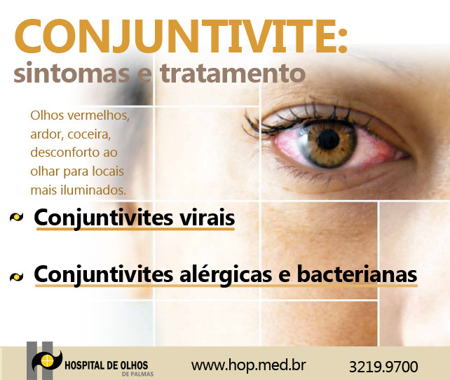 CONJUNTIVITE Sintomas e Tratamento