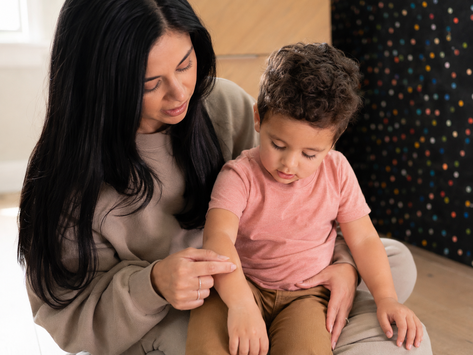 Baby eczema relief cream applied to toddler with eczema flare ups