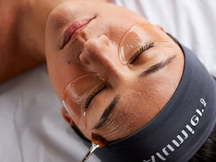 A professional facial peel treatment