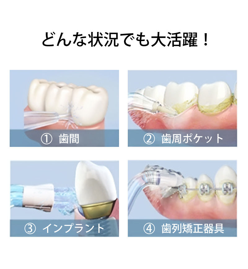 サムネイル： 口腔洗浄器 ウォーターピック 1台2役 歯ブラシ