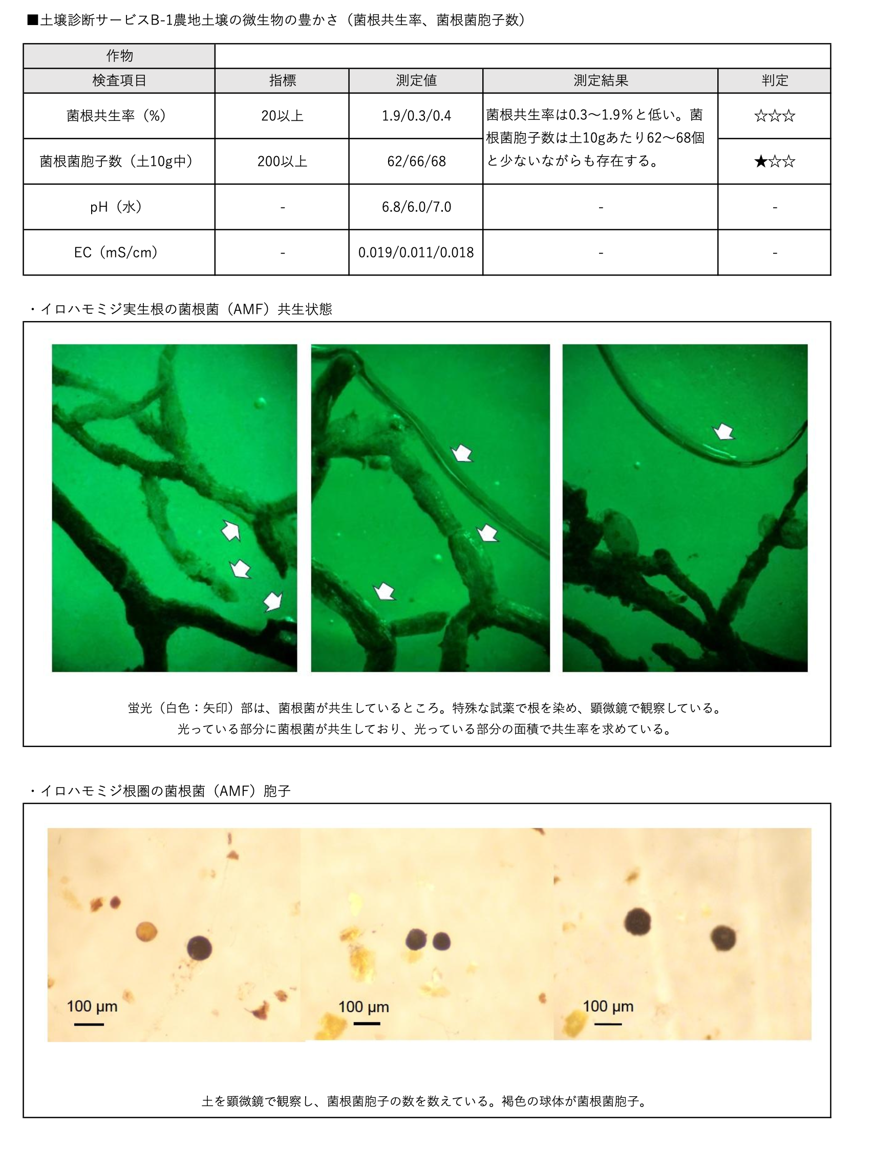 尾上別荘庭園の菌根菌顕微鏡写真 共生率0.3〜1.9%