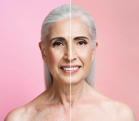 before-after-el-medical-mature-woman-botox.jpg