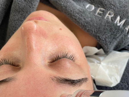 Hydrafacial?- Hydrabrasie