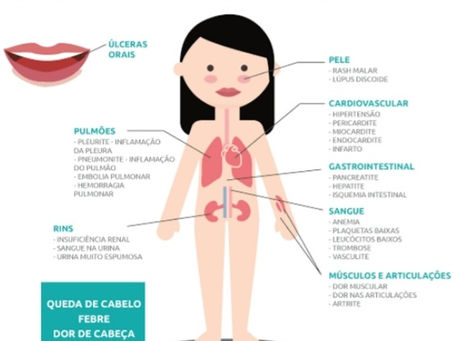 VAMOS FALAR SOBRE FIBROMIALGIA???