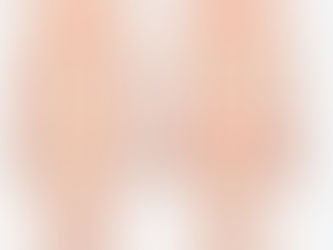 Vamos falar sobre fibromialgia (FM) ???