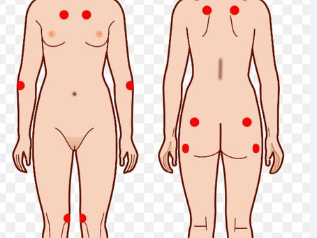 Vamos falar sobre fibromialgia (FM) ???
