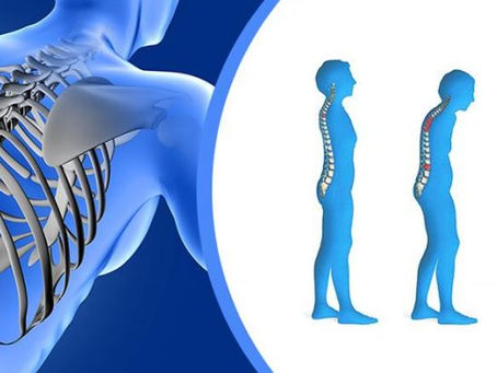Você sabe o que é osteoporose?