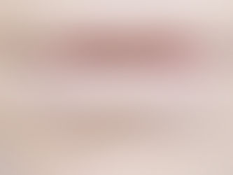 Vamos conhecer um pouco sobre a sindrome de Sjogren???
