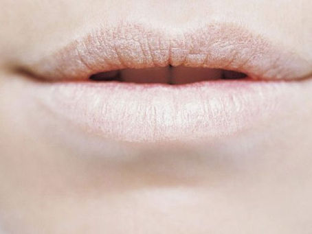 Vamos conhecer um pouco sobre a sindrome de Sjogren???