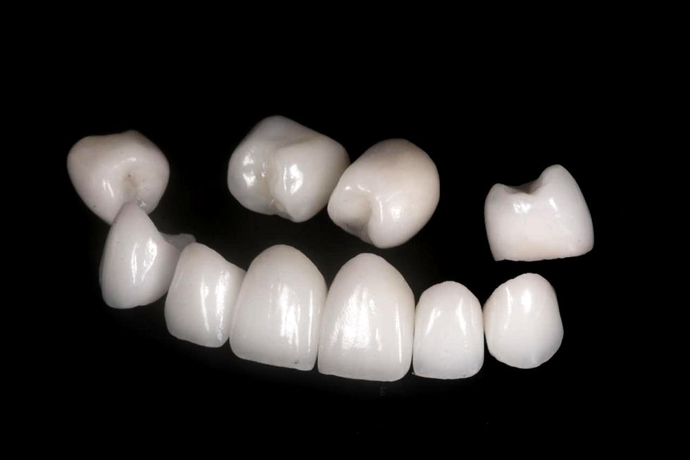Coroa ou bloco dentário: qual a diferença e quando cada um é indicado?
