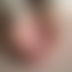 Como prevenir o câncer de mama: dicas importantes