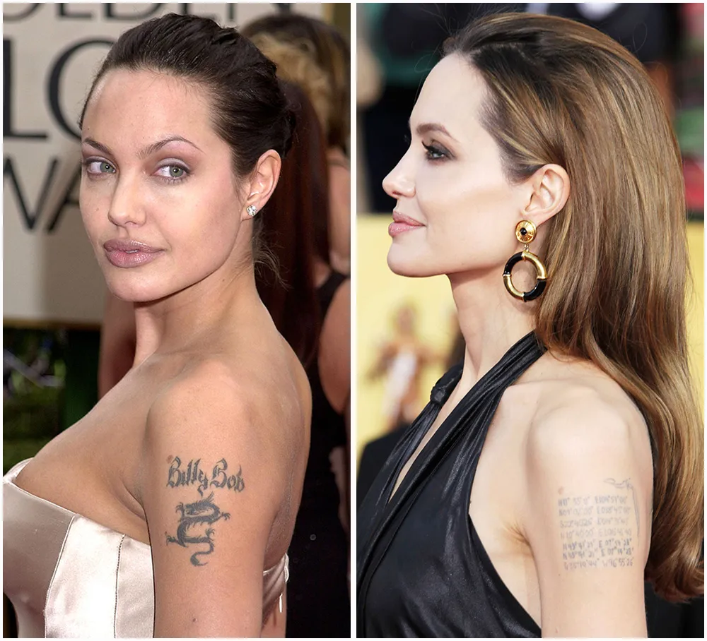 angelina jolie billy bob tattoo removal