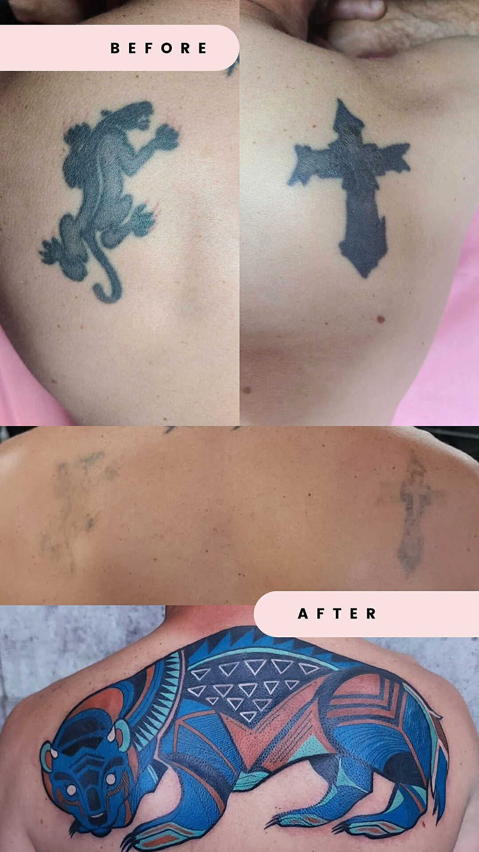 tattoo removal and cover up package results from reth-ink in hamilton ontario
