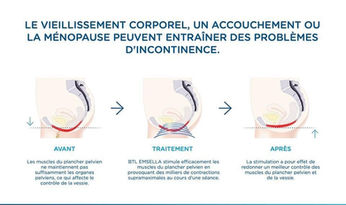 des muscles du plancher pelvien et de la vessie_