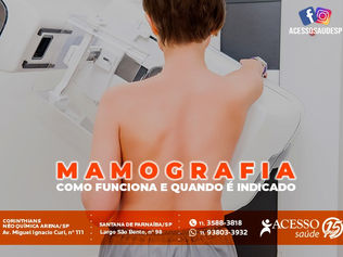 Mamografia: como é feita, quando é indicada e dúvidas comuns