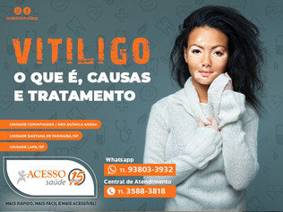 Vitiligo: o que é, causas e tratamento